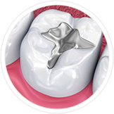 Профилактика зубного кариеса - изображение 5