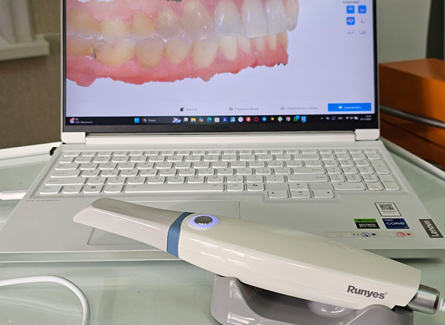 Сканирование зубов